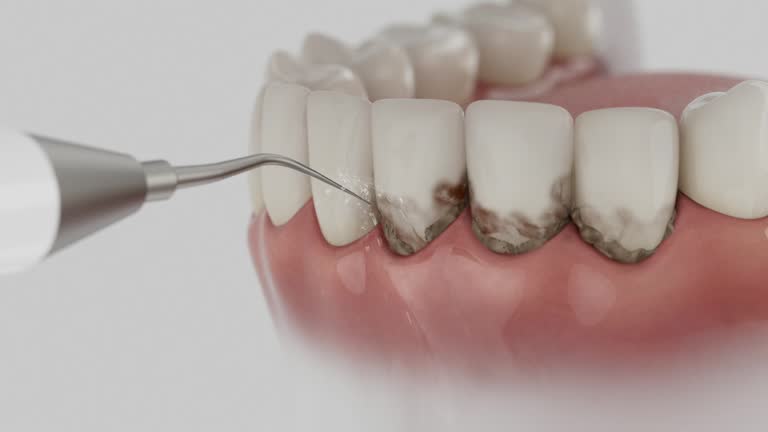 Trusted Root Canal Treatment service in Gower, MO - Dentist Open Now